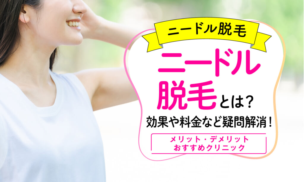 ニードル脱毛とは？効果ない？料金や痛みなどの疑問も解消！ アーバンライフ東京