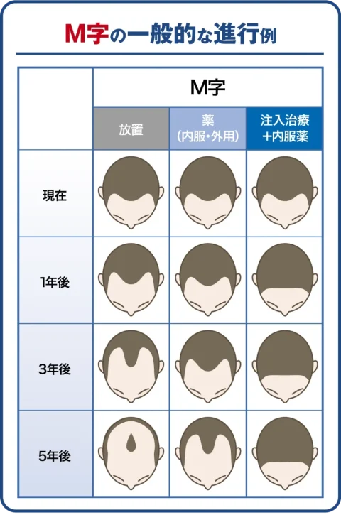 M字の一般的な進行例と治療後のイメージ