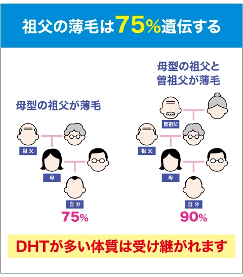 DHTが多い体質は遺伝する
