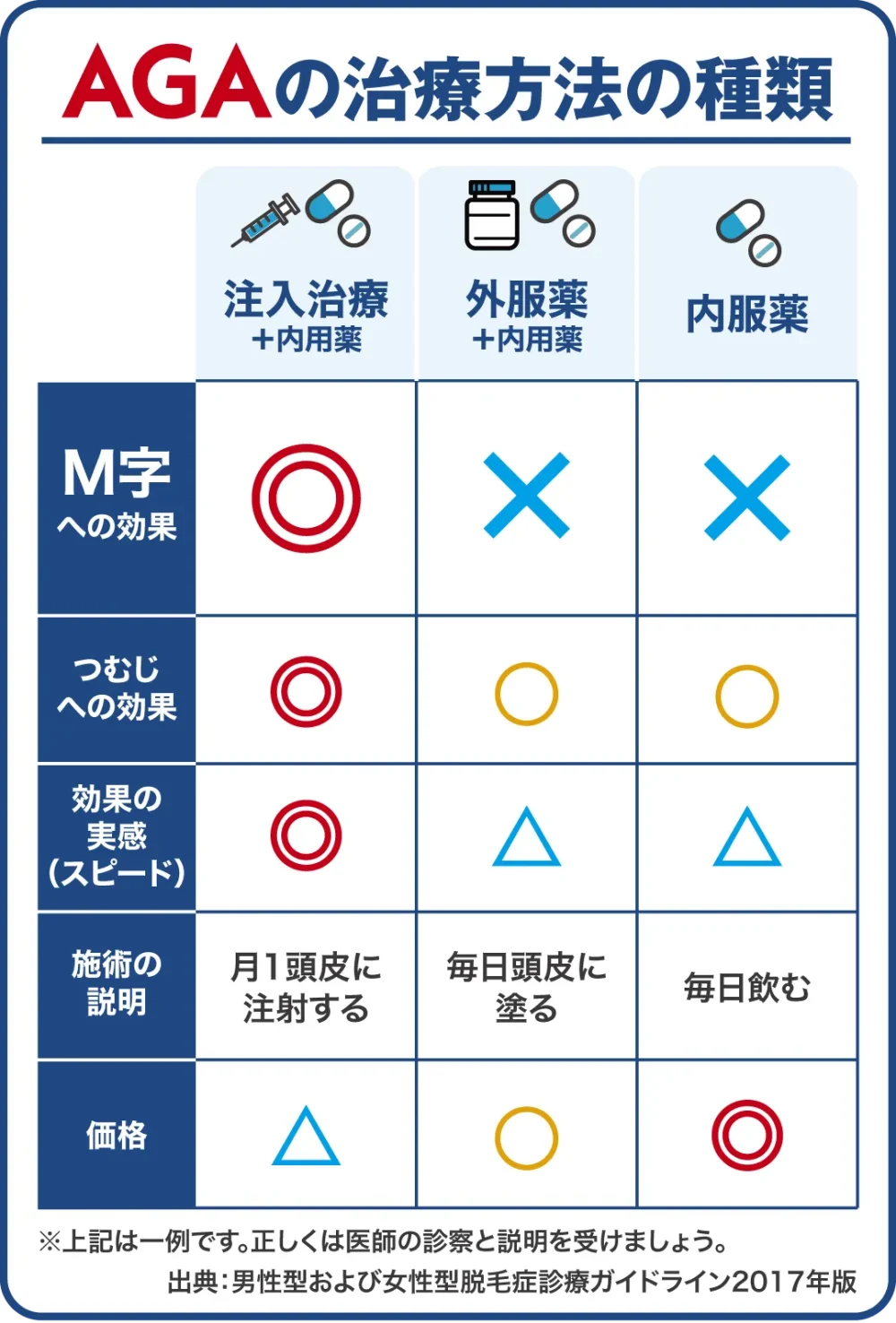 AGAの治療方法の種類