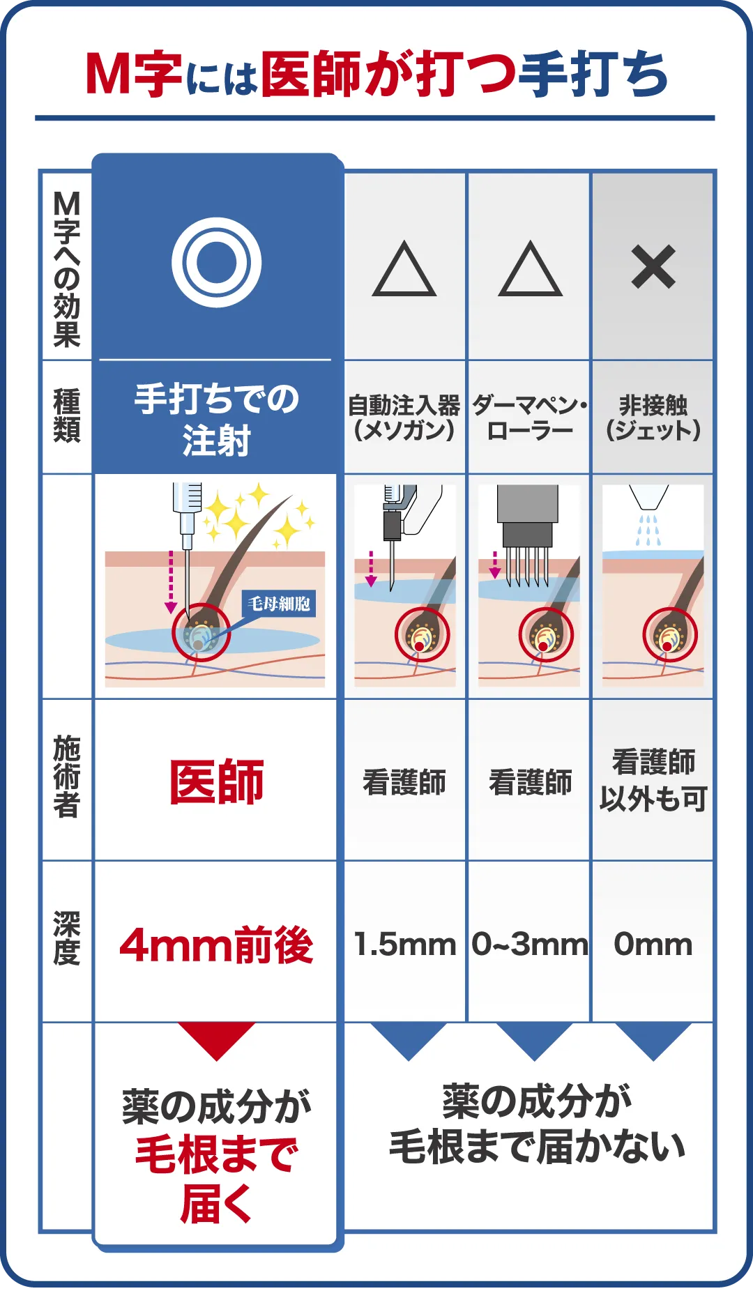 M字には医師が打つ手打ちでの注射で薬の成分が毛根まで届く