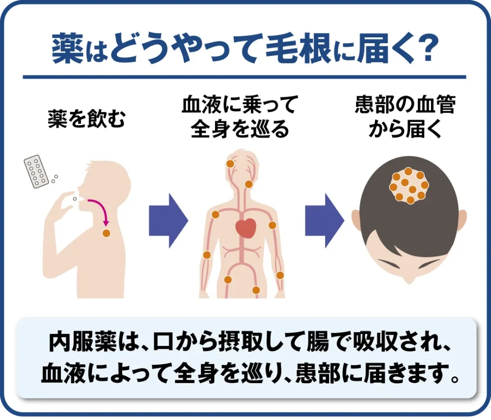 薬はどうやって毛根に届く？ー内服薬は、口から摂取して腸で吸収され、血液によって全身を巡り、患部に届きます