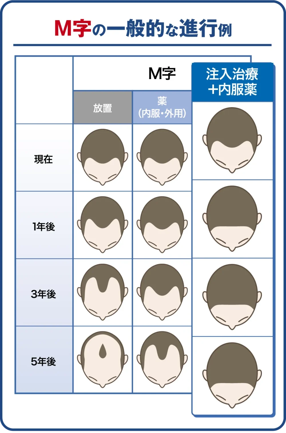 M字の一般的な進行例と治療後のイメージ